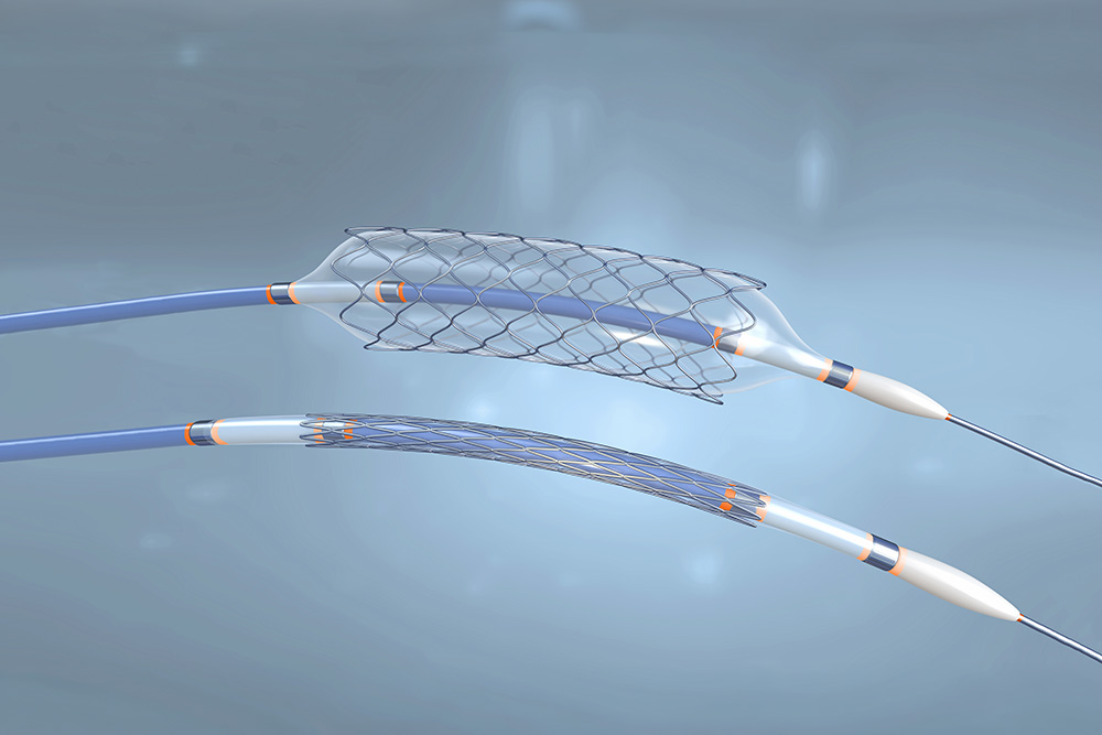 Catheter and Guidewire Assembly