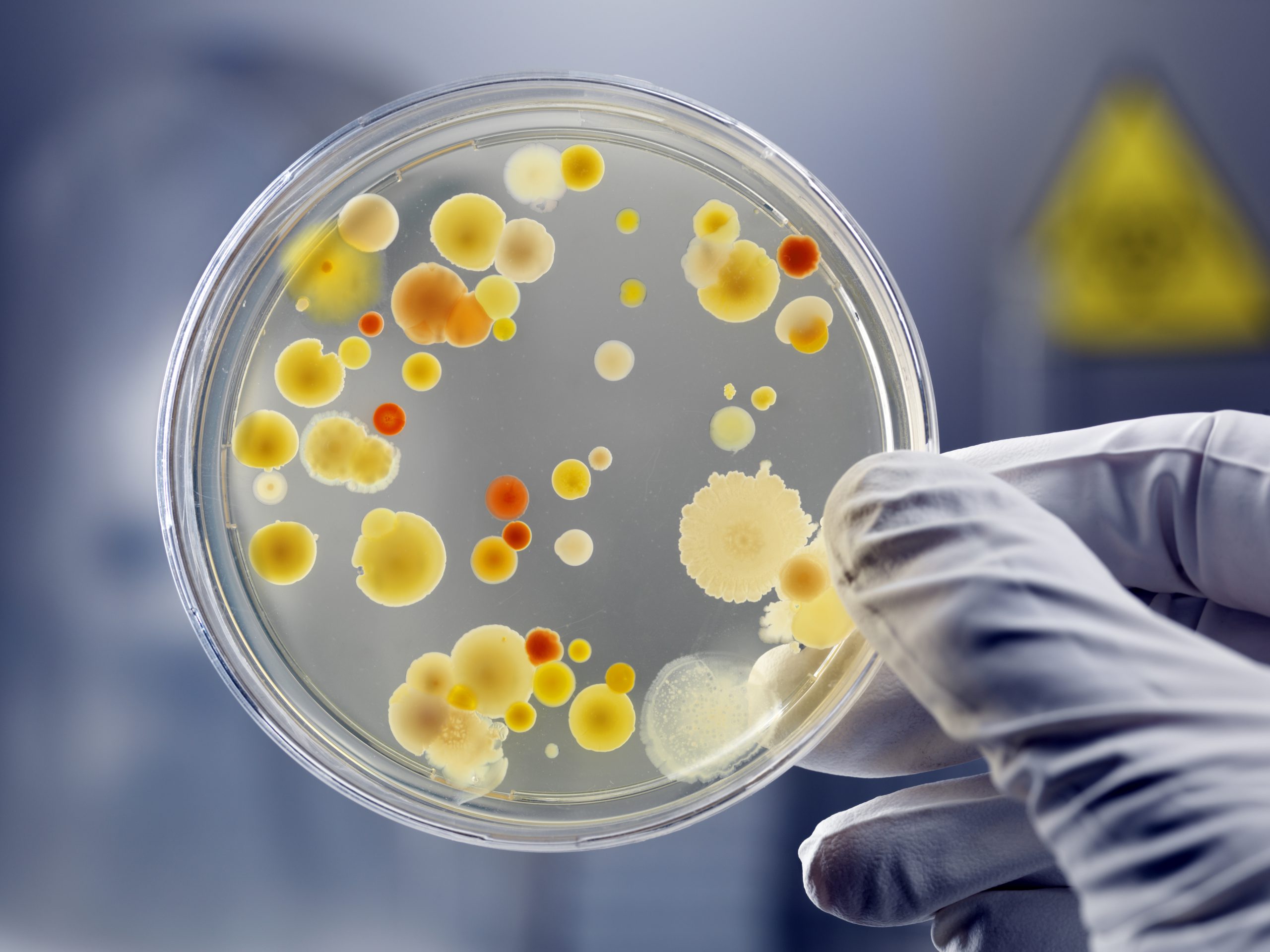 Petri dish with aerobic bacteria culture on agar plate, biohazard sign in background, under UV light for laboratory testing.